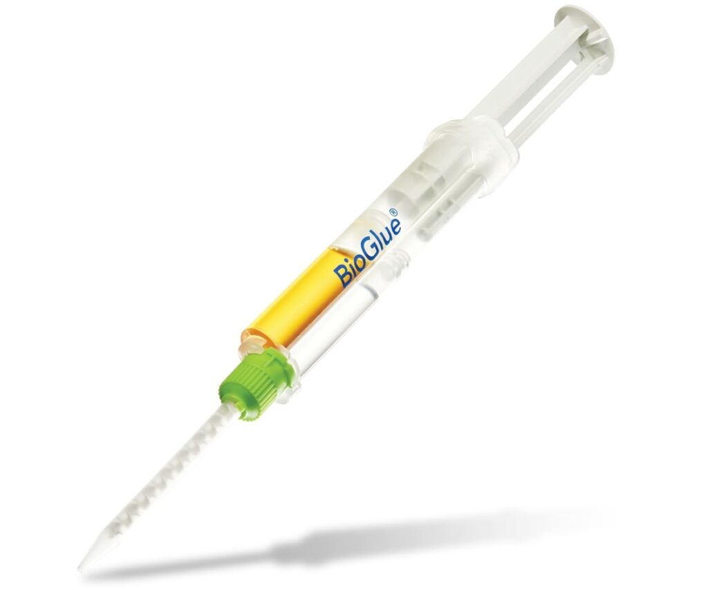 BioGlue® SURGICAL ADHESIVE – Medelixi
